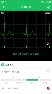 极简心电网页版截图4